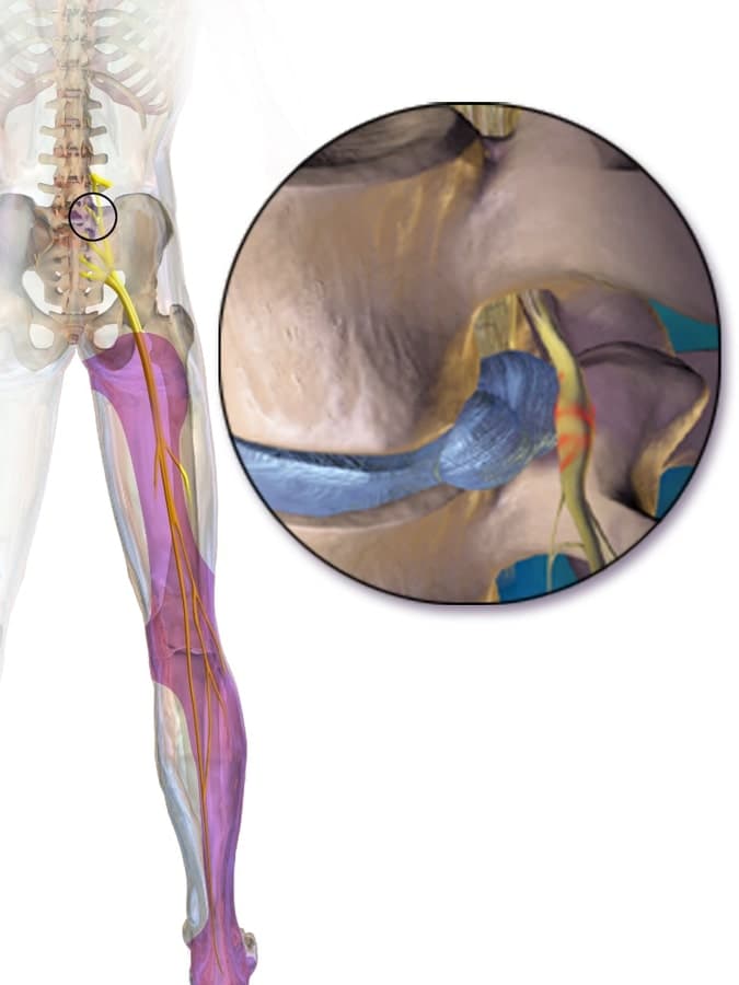 sciatic-nerve